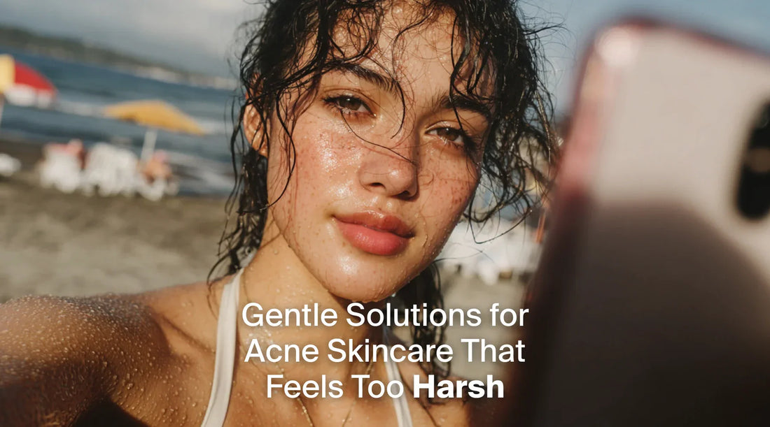 Gentle Solutions for Acne Skincare That Feels Too Harsh