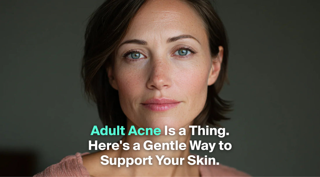 A woman with a calm expression looks into the camera as on-screen text discusses gentle skincare for adult acne.