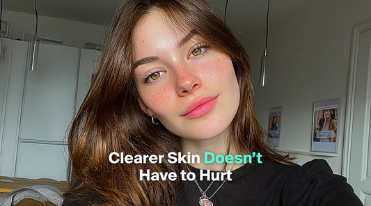 A young woman with brown hair, freckles, and green eyes looks toward the camera, with the text overlay "Clearer Skin Doesn't Have to Hurt".