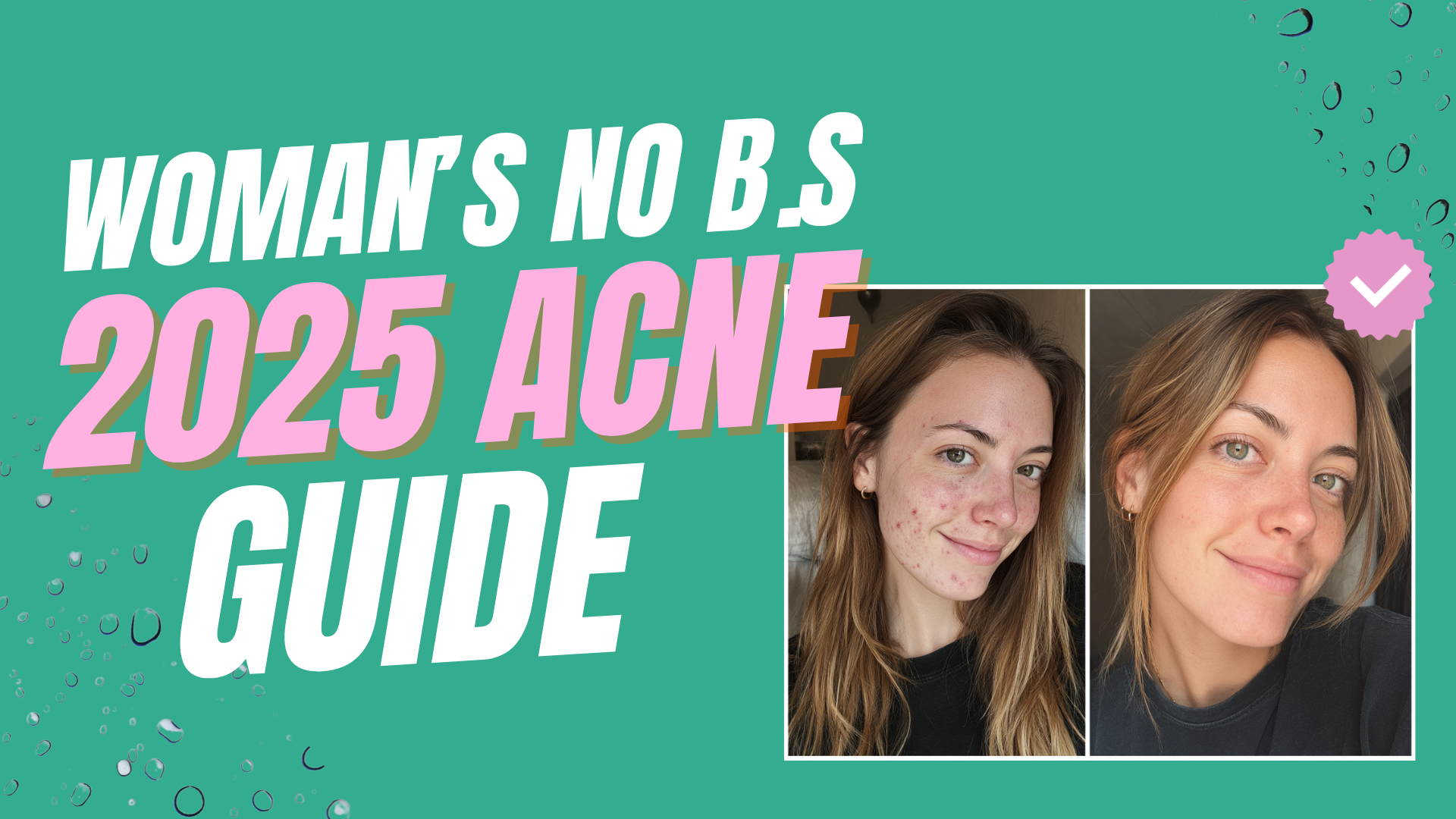 What Makes Acne Worse? A No-BS Guide for Women in Their 20s