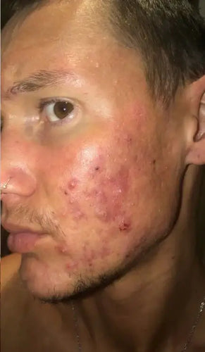 Before - Day 1