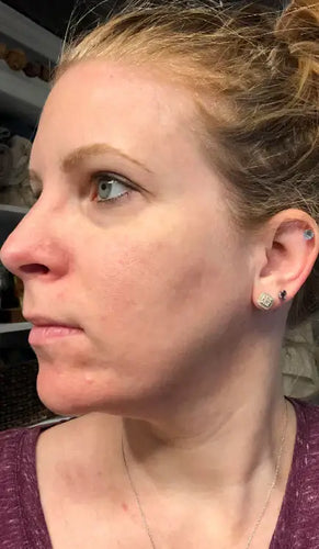 After - Day 30