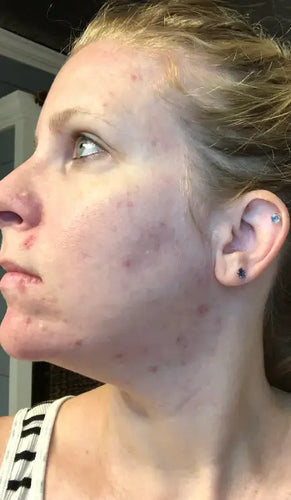 Before - Day 1