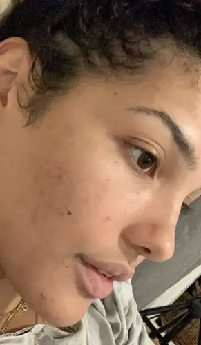 After - Day 40