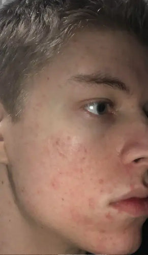 After - Day 42